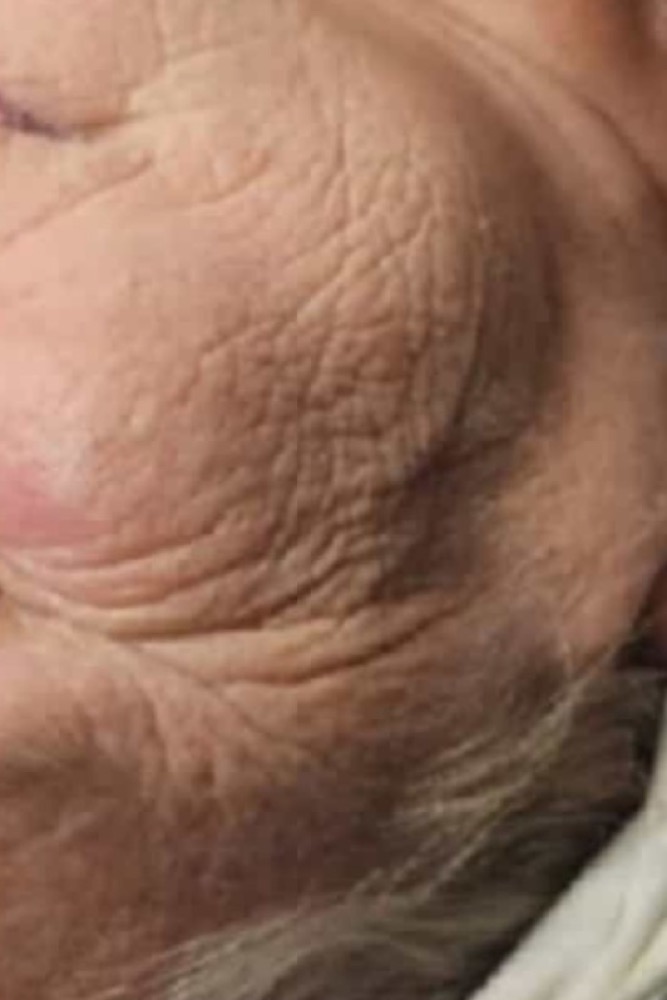 Gesichtslinien vor der kosmetischen Anwendung